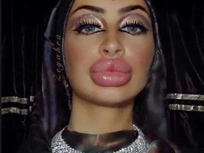 Вижте жените с най — грозните устни в света (ШОК СНИМКИ)