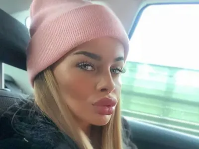 Сузанита се обезобрази на 16