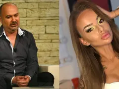 Орхан Мурад: Сузи съжалява за хиалурона, други корекции няма!