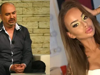 Орхан Мурад: Сузи съжалява за хиалурона, други корекции няма!