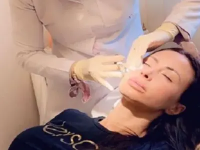 Шефката на силиконките трие бръчки