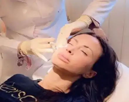 Шефката на силиконките трие бръчки