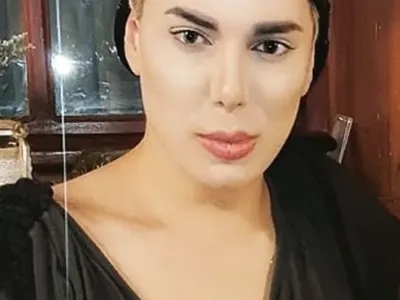 Дали Кулагин сменя носа си?!