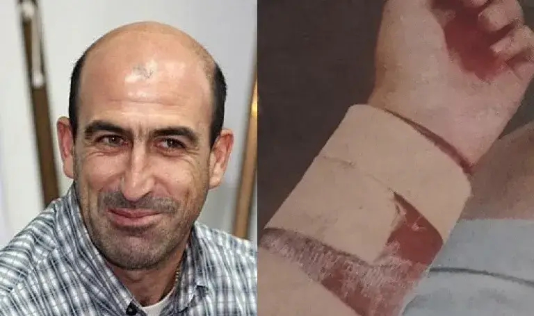 Кучета на Лечков наръфаха момиче! Голяма работа, случва се, казва ексфутболистът