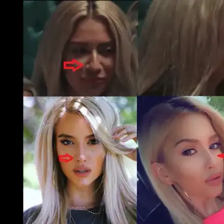 Опаа! И Тита ли си клъцна носа?! Певицата премахна гърбица и широки ноздри (Подробности)