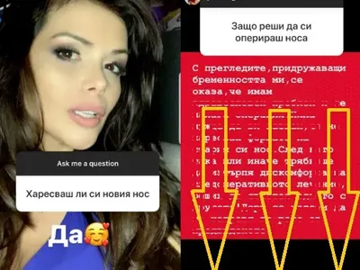 Преслава проговори: Харесвам си НОСА! Певицата разкри и ПРИЧИНАТА да легне под ножа