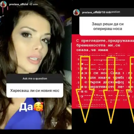 Преслава проговори: Харесвам си НОСА! Певицата разкри и ПРИЧИНАТА да легне под ножа