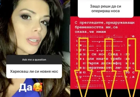 Преслава проговори: Харесвам си НОСА! Певицата разкри и ПРИЧИНАТА да легне под ножа