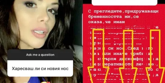 Преслава проговори: Харесвам си НОСА! Певицата разкри и ПРИЧИНАТА да легне под ножа