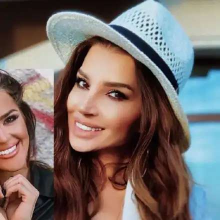 След серия от пластики: Есил Дюран стана копие на Бориса