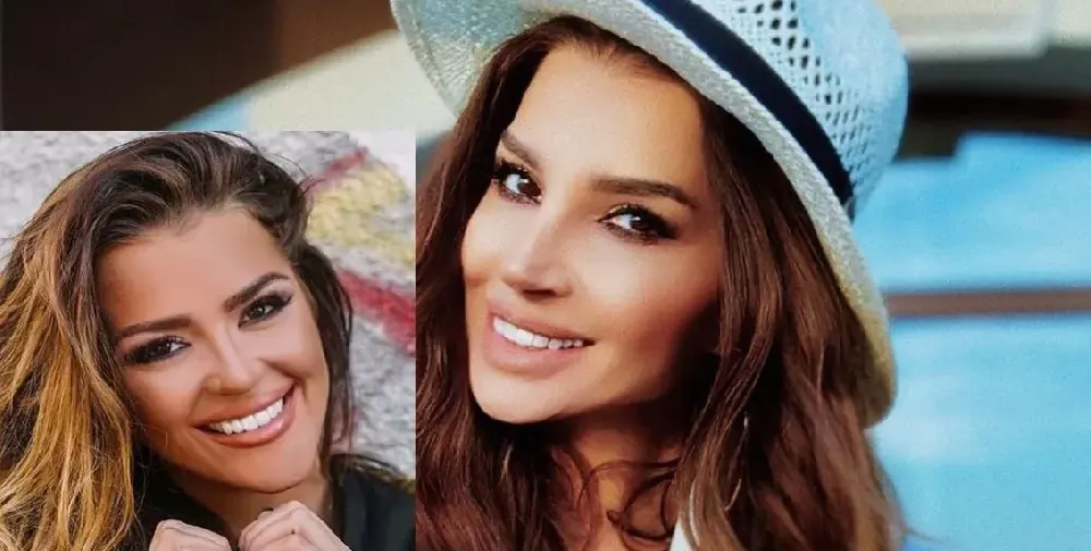 След серия от пластики: Есил Дюран стана копие на Бориса