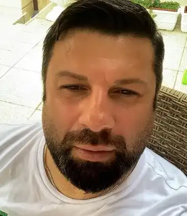 Тони Стораро опъна бръчки с фотошоп