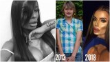 Трансджендърът Филип в разтърсваща изповед: В училище ми избиха зъбите, преминах през ада, за да съм жена