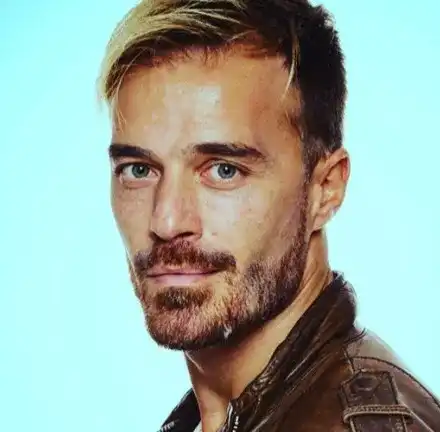 Ники Илиев обезобразен от витилиго (Лицето на красавеца цялото на петна)