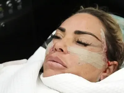 Пращат Джордан в лудница заради зависимостта й към корекциите