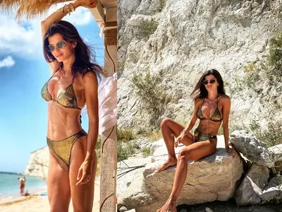 Славена Вътова сложи силикон