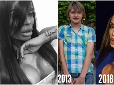 Трансджендърът Филип в разтърсваща изповед: В училище ми избиха зъбите, преминах през ада, за да съм жена