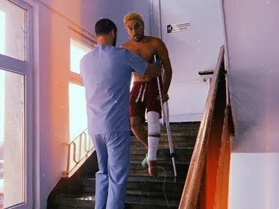 Бебо Халваджиян показва гипса