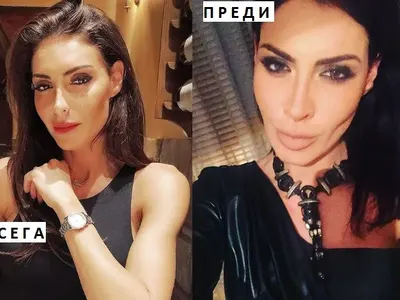 Черната Златка си клъцна носа! Феновете намират прилики с този на Преслава