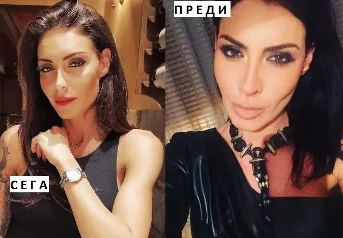 Черната Златка си клъцна носа! Феновете намират прилики с този на Преслава