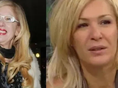 Гала копие на Муки от корекции