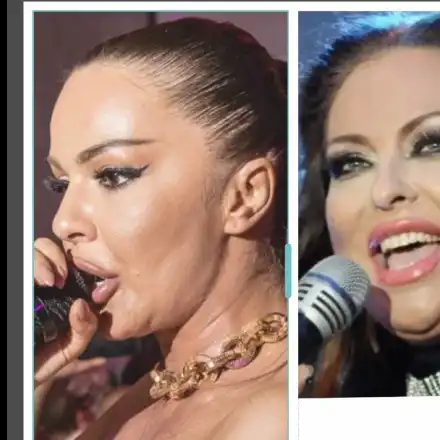 Галена обвинява Преслава, че копира нейния нос, а забравя, че е откраднала гушата и килограмите на Ивана (СНИМКИ)