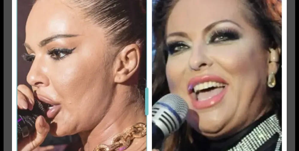 Галена обвинява Преслава, че копира нейния нос, а забравя, че е откраднала гушата и килограмите на Ивана (СНИМКИ)