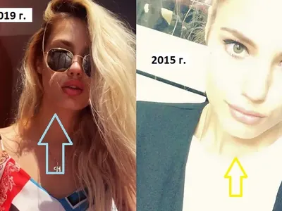 Кристин Илиева започна и с лицевите подобрения! Красавицата напомпа сочни джуки, завръща се на модния подиум