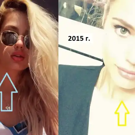 Кристин Илиева започна и с лицевите подобрения! Красавицата напомпа сочни джуки, завръща се на модния подиум