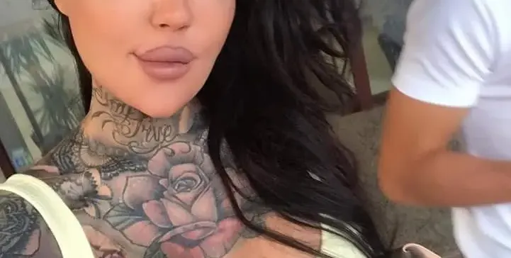 Лекари забраниха пластиките на Никита Джонсън