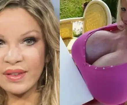 Луда моделка с 330 пластични операции и германката с най-големите бомби празнуват Световния ден на красотата (Шокиращи снимки)