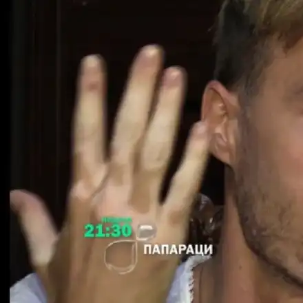 Ники Илиев в откровено интервю за витилигото, бившата му съпруга и предстоящия му филм