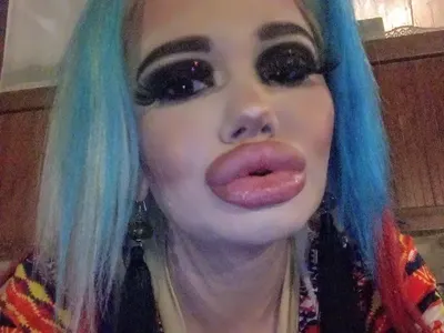 ПОТРЕС: Българското Барби с 16-а операция! Германски екип снима филм за родния „феномен”