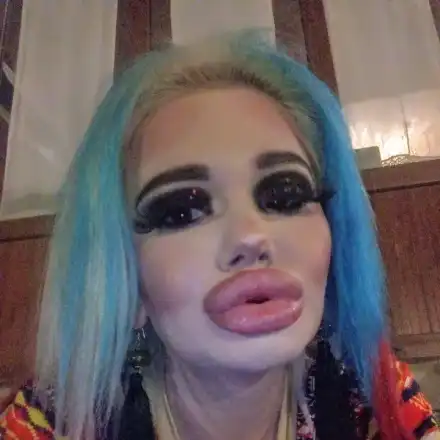 ПОТРЕС: Българското Барби с 16-а операция! Германски екип снима филм за родния „феномен”