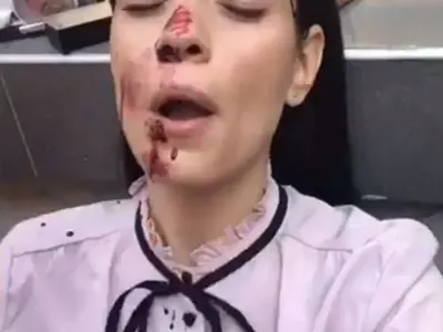 С три вида кръв мажат д-р Стилянова, актрисата шофира в ужасяващ вид след брутална сцена (Снимки)