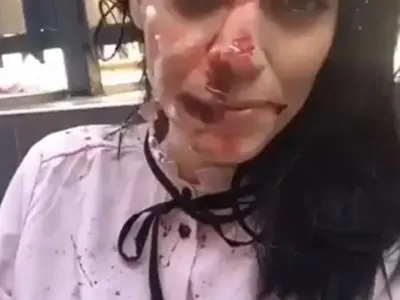 С три вида кръв мажат д-р Стилянова, актрисата шофира в ужасяващ вид след брутална сцена (Снимки)