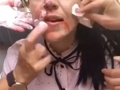 С три вида кръв мажат д-р Стилянова, актрисата шофира в ужасяващ вид след брутална сцена (Снимки)