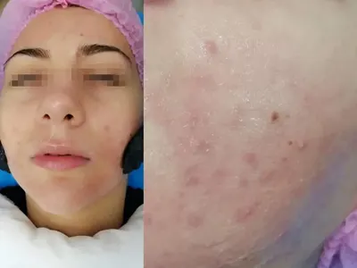 Най-красивата лекарка - Полина Паньова сбъдва мечти преди Коледа (Снимки)