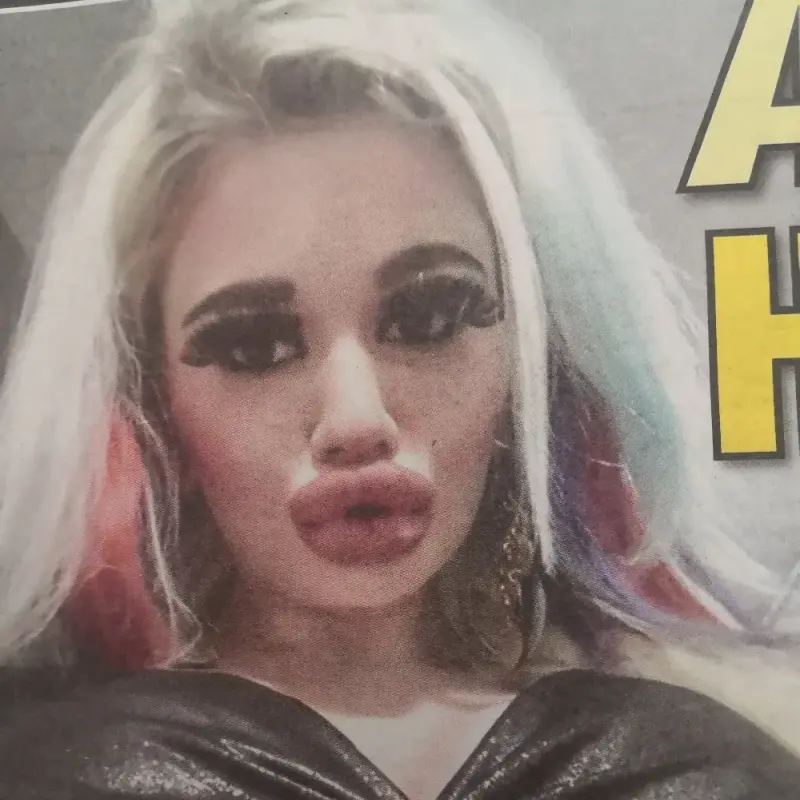 БГ Барбито Андреа: Ще си направя най-големите джуки в света! (Блондито с 18-я операция)