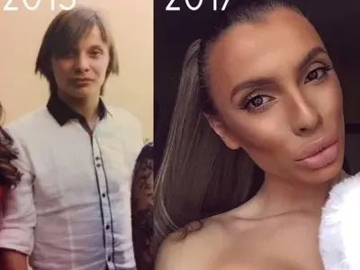 Кюстендилец е най-младият трансджендър на Балканите