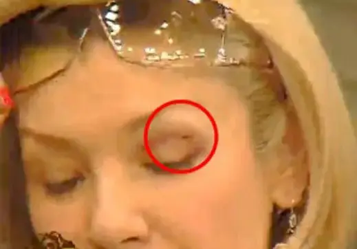 Котката на Гала откачи и я надра по лицето