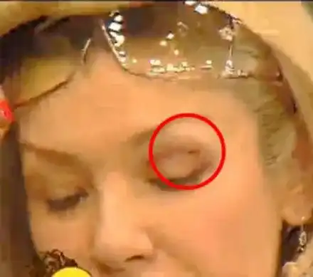 Котката на Гала откачи и я надра по лицето