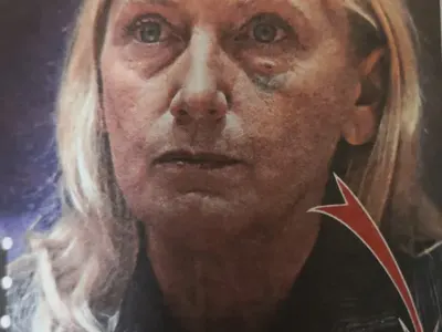 Защо Елена Йончева е с насинено око в Европарламента?