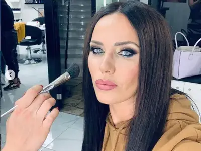 Мария Силвестър пострада от филъри