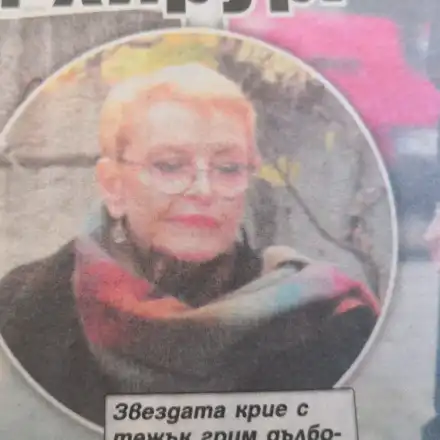 Пластичен хирург окепази Камелия Тодорова (Лицето на певицата увисна - Фото)