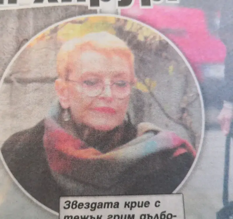 Пластичен хирург окепази Камелия Тодорова (Лицето на певицата увисна - Фото)