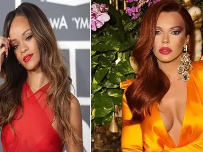 Пластичен хирург превърна Галена в копие на Риана