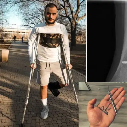 Лъчо от „СкандаУ” с 6 пирона в глезена, Луиза и Криско се пребиха с мотор, Кеца пее със счупени зъби, Азис с разбита глава...