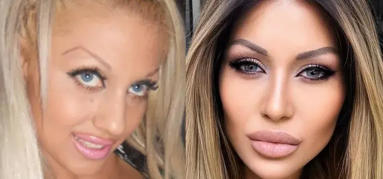 Джулиана Гани вкарала 150 бона в пластични операции, прясната майка няма нищо общо с натуралния си вид