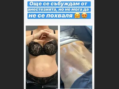 Жени Джаферович махна мазнините